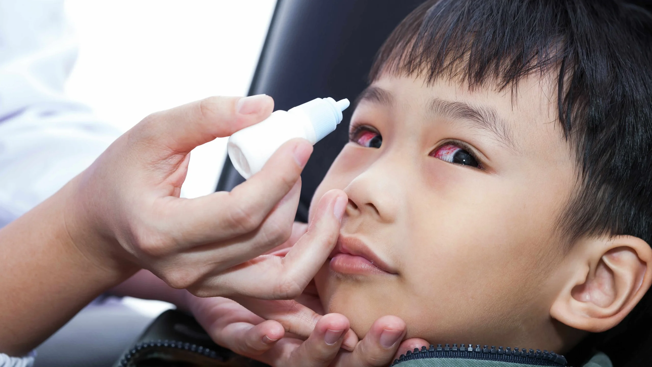 bị đau mắt đỏ có kiêng thịt gà không?