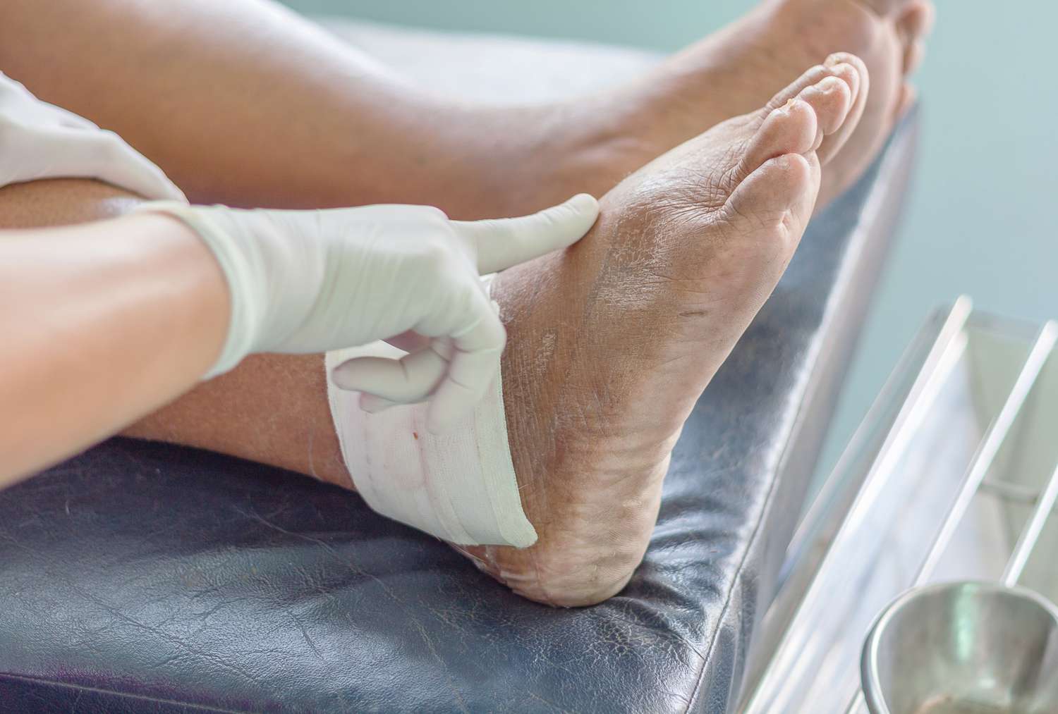 Người mắc bệnh gout