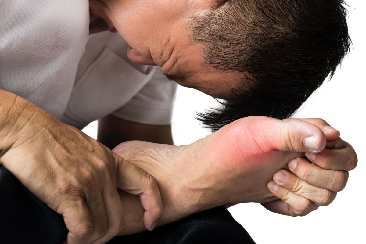 trị gout
