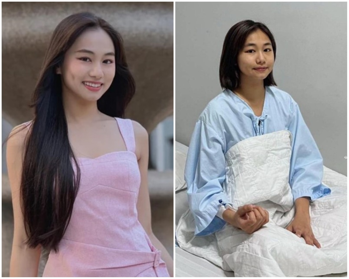 nguyên nhân gây suy thận